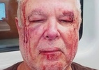policia-investiga-agressao-a-idoso-em-copacabana-por-motivacao-politica