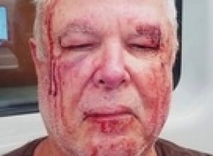 policia-investiga-agressao-a-idoso-em-copacabana-por-motivacao-politica